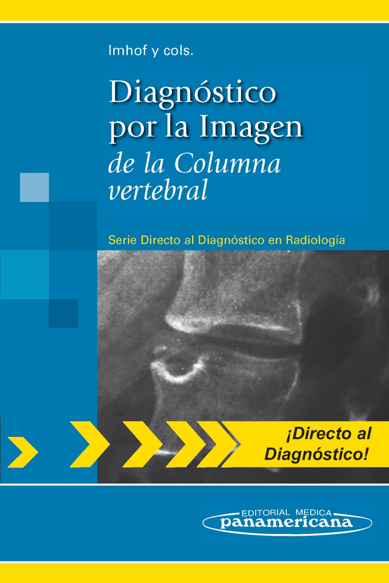 Diagnóstico por la Imagen de la Columna vertebral Serie Directo al