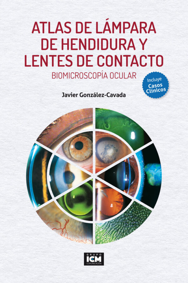 Atlas de Lámpara de Hendidura y Lentes de Contacto. Biomicroscopía Ocular