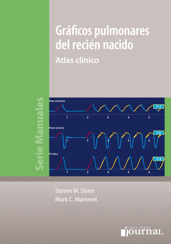 GRAFICOS PULMONARES DEL RECIEN NACIDO 2016