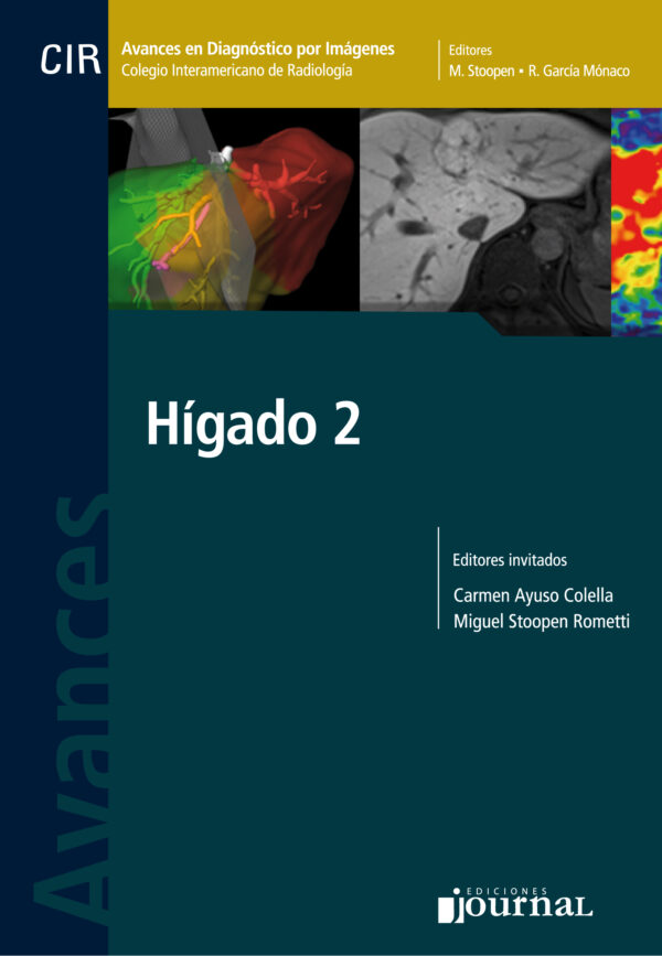 HÍGADO 2- Avances en Diagnóstico por Imágenes  ED. 2018.