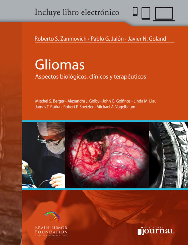 Gliomas (Aspectos biológicos, clínicos y terapéuticos) + E-Book