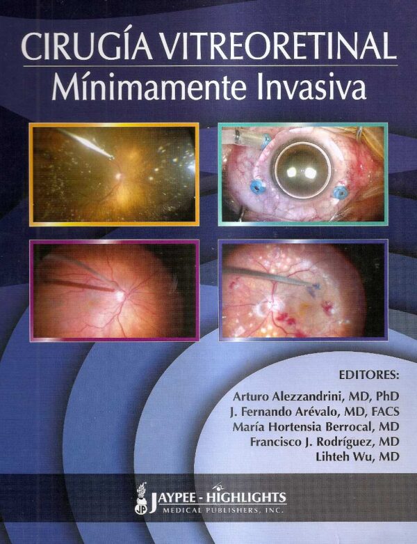 Cirugía vitreoretinal mínimamente invasiva