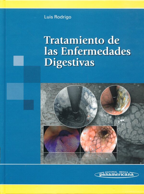 Tratamiento de las Enfermedades Digestivas