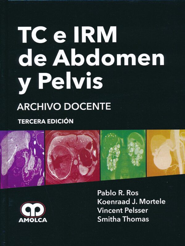 TC E IRM ABDOMEN Y PELVIS