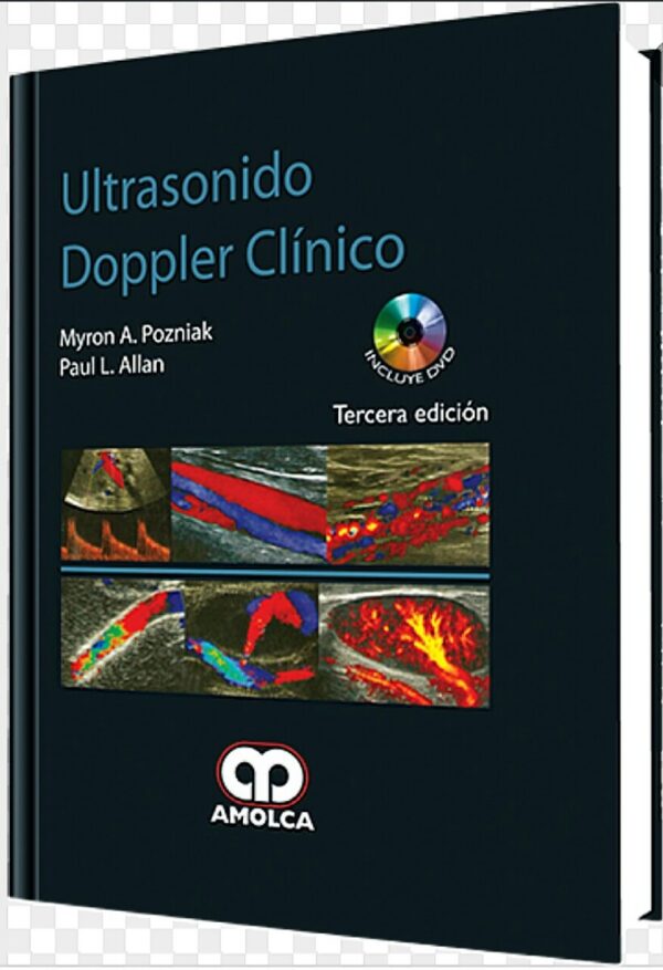 Ultrasonido Doppler Clínico