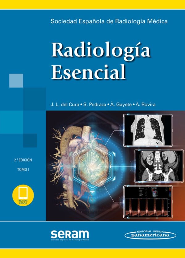 Radiología Esencial (incluye versión digital) (2 Tomos)